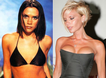 Victoria Beckham thừa nhận bơm ngực vì mặc cảm vòng 1 nhỏ và giờ đã hối hận - Ảnh 2.