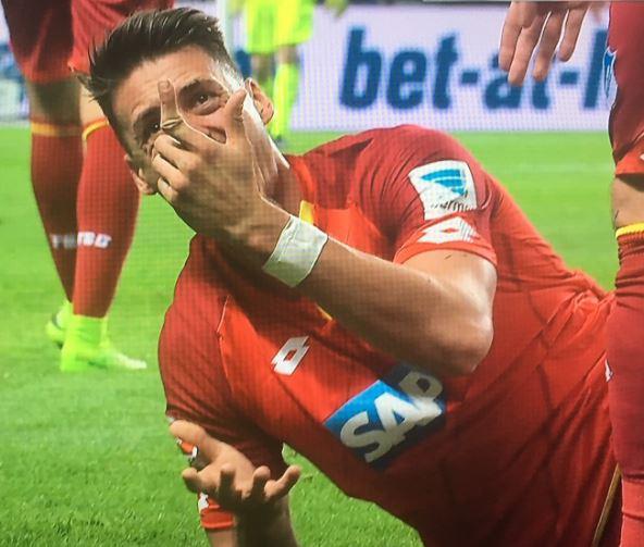 Sao Bundesliga gãy gập ngón tay kinh dị - Ảnh 1.