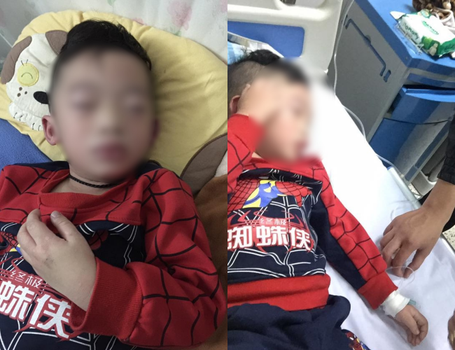 H&agrave; Nội: Tin đồn b&eacute; trai sưng v&ugrave; mặt phải cấp cứu v&igrave; uống tr&agrave; sữa, bệnh viện Nhi TW n&oacute;i g&igrave;? - Ảnh 2.