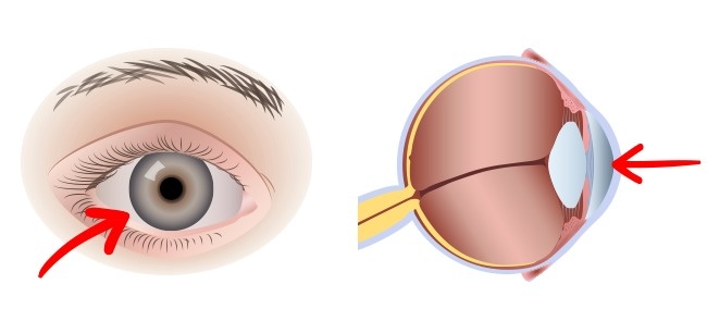 Ăn 2 quả trứng mỗi ngày và xem điều gì sẽ xảy ra với cơ thể bạn? - Ảnh 6.