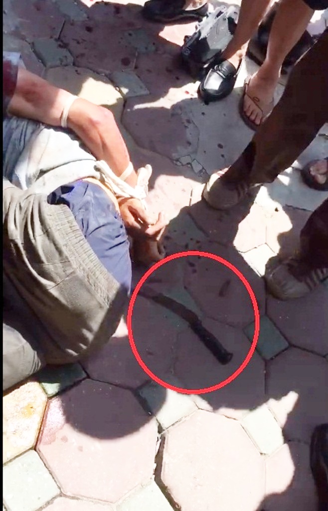 Người đàn ông nghi ngáo đá cầm dao đâm cặp vợ chồng cùng nhiều người đi đường ở Hà Nội - Ảnh 2.