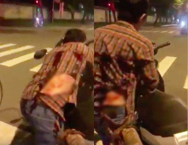 Cãi nhau sau va chạm giao thông, tài xế ô tô cầm rìu chém tới tấp vào lưng người đàn ông ở Sài Gòn - Ảnh 3.