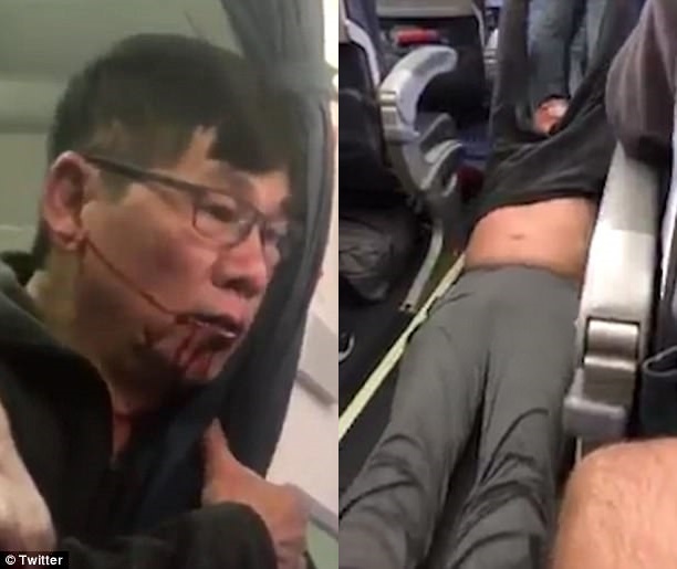 Hành khách thân thiết của United Airlines bẻ nát thẻ thành viên sau vụ bác sĩ gốc Việt bị kéo lê khỏi máy bay - Ảnh 1.