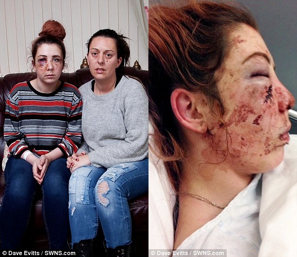 C&ocirc; g&aacute;i tự kỷ bị tấn c&ocirc;ng d&atilde; man đến nỗi mẹ c&ograve;n kh&ocirc;ng nhận ra được con g&aacute;i - Ảnh 2.