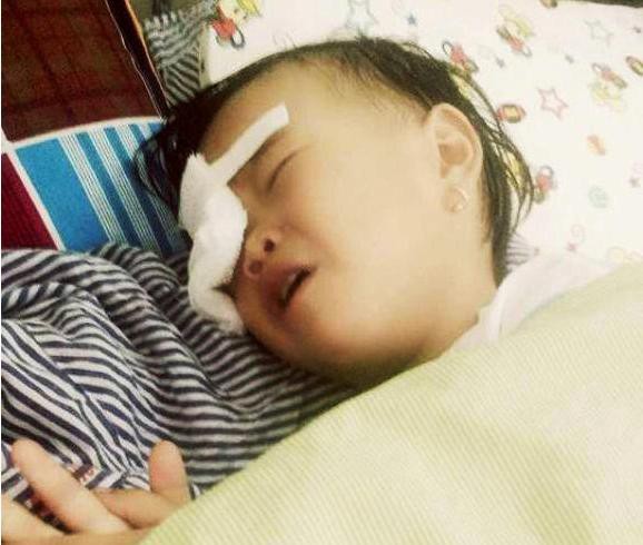 Nghệ An: Bé gái 2 tuổi bị gà chọi đá, nguy cơ hỏng mắt phải - Ảnh 1.