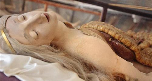 Thần vệ nữ bị mổ bụng - những người đẹp giải phẫu 200 tuổi khiến y học cúi đầu - Ảnh 5.