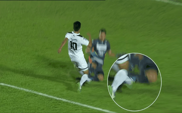 Người mẹ kh&oacute;c nấc khi chứng kiến cậu con trai lớn bị &ldquo;ch&eacute;m&rdquo; g&atilde;y ch&acirc;n - Ảnh 2.