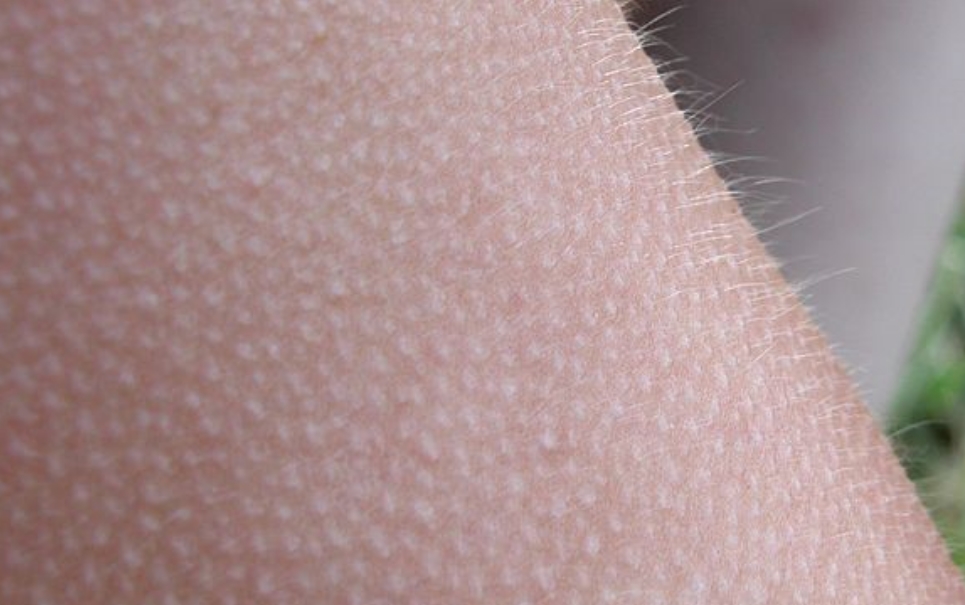 C&oacute; 1 bộ phận duy nhất tr&ecirc;n cơ thể kh&ocirc;ng bao giờ &ldquo;nổi da g&agrave;&rdquo;, bạn sẽ shock khi biết kết quả! - Ảnh 4.