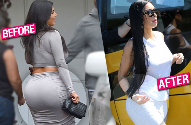 Mặc độc quần bơi khoe vòng 3, Park Bom bị nghi phẫu thuật bơm mông giống Kim Kardashian - Ảnh 4.