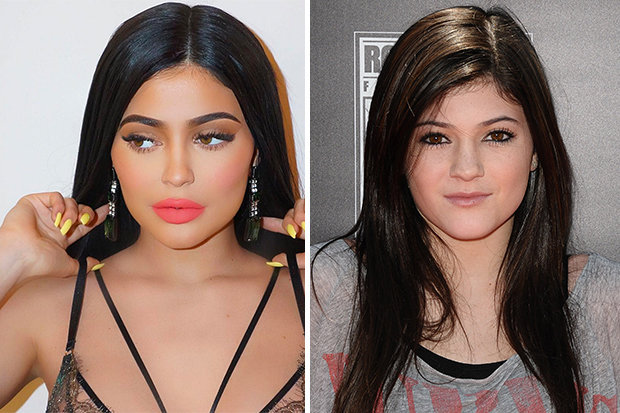 Đẹp nhờ dao kéo, Kylie Jenner lo khuôn mặt kém xinh trước đây sẽ di truyền cho con? - Ảnh 3.