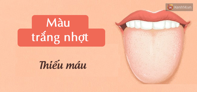 Lưỡi có 4 biểu hiện này, hãy đi kiểm tra sức khoẻ cấp tốc - Ảnh 2.