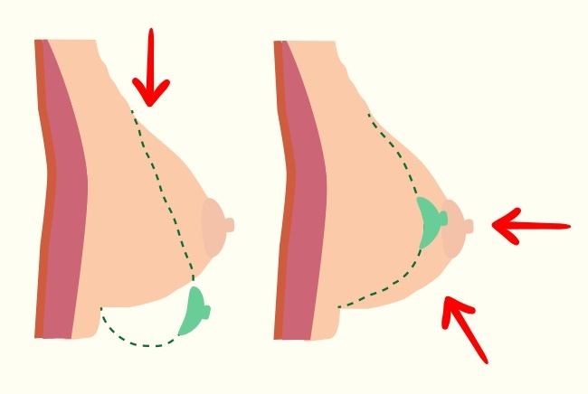 4 lý do cho thấy những người ít mặc áo ngực sẽ có vòng 1 khoẻ và đẹp hơn - Ảnh 1.