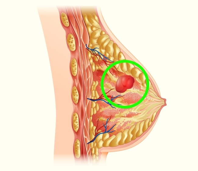 4 lý do cho thấy những người ít mặc áo ngực sẽ có vòng 1 khoẻ và đẹp hơn - Ảnh 3.