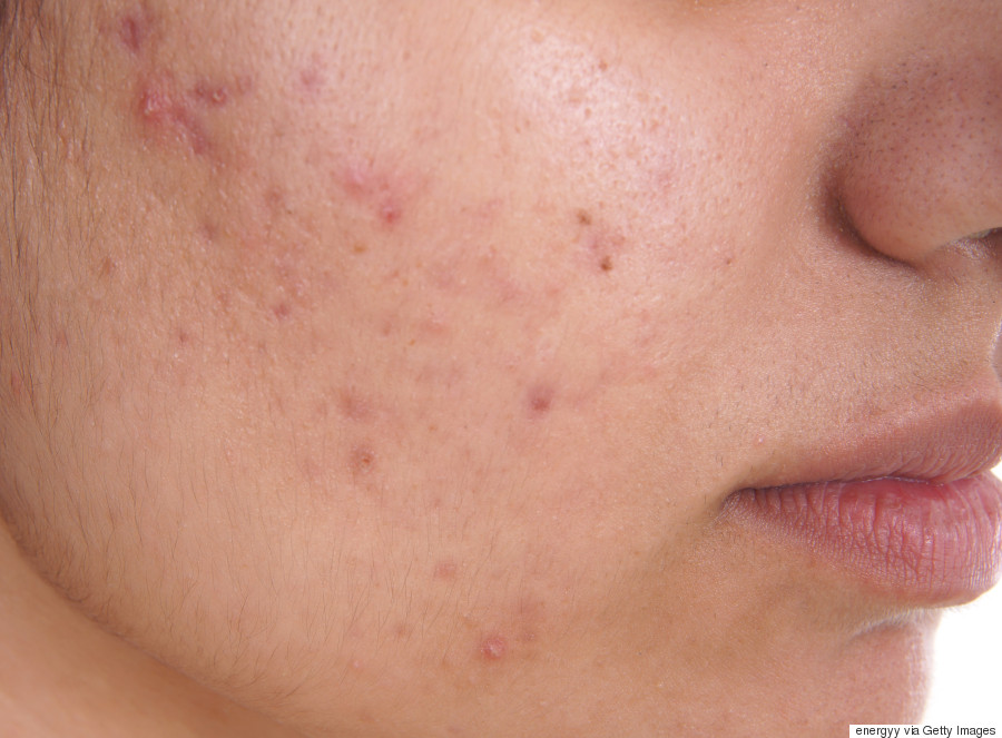 Nếu biết ngủ muộn ảnh hưởng nhan sắc thế n&agrave;y, c&aacute; l&agrave; bạn kh&ocirc;ng d&aacute;m thức qua 10h đ&acirc;u! - Ảnh 3.