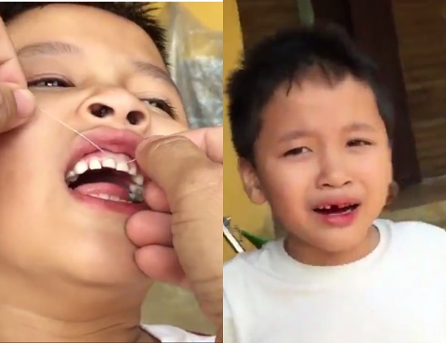 Clip: &Ocirc;ng bố nhổ răng cho con trai bằng... xe m&aacute;y - Ảnh 2.