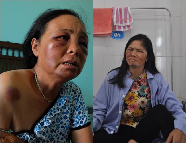 Người th&acirc;n nh&oacute;m người h&agrave;nh hung đến nh&agrave; xin lỗi 2 phụ nữ b&aacute;n tăm bị đ&aacute;nh oan v&igrave; nghi bắt c&oacute;c trẻ em - Ảnh 2.