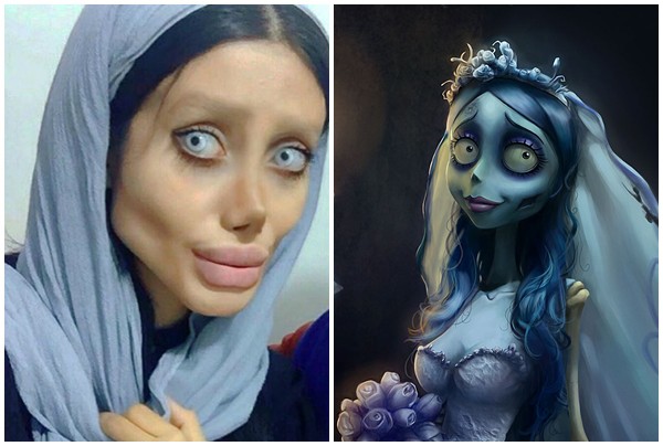 Cô gái phẫu thuật thẩm mỹ hơn 50 lần để nhìn giống Angelina Jolie, kết quả trả về gia tinh Dobby - Ảnh 5.