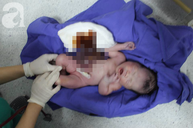 Quảng Ninh: Một bé gái sơ sinh lộ nguyên nội tạng ngoài bụng được cứu sống thần kỳ - Ảnh 1.