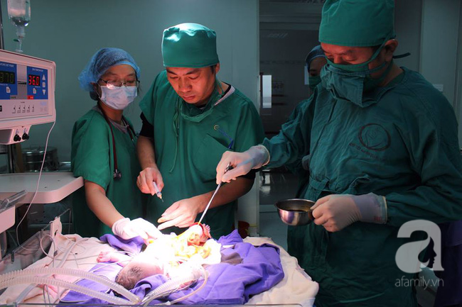 Quảng Ninh: Một b&eacute; g&aacute;i sơ sinh lộ nguy&ecirc;n nội tạng ngo&agrave;i bụng được cứu sống thần kỳ - Ảnh 2.