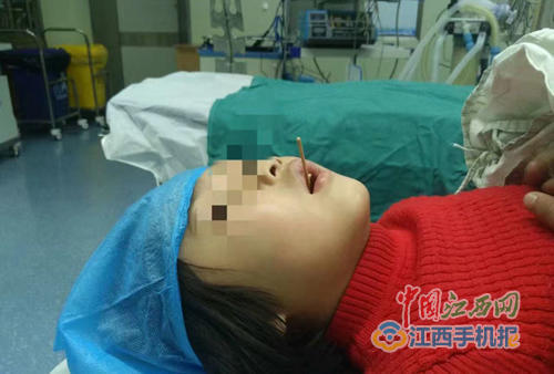 Đừng chủ quan: B&eacute; g&aacute;i ăn x&uacute;c x&iacute;ch bị que xi&ecirc;n đ&acirc;m xuy&ecirc;n cổ họng - Ảnh 2.