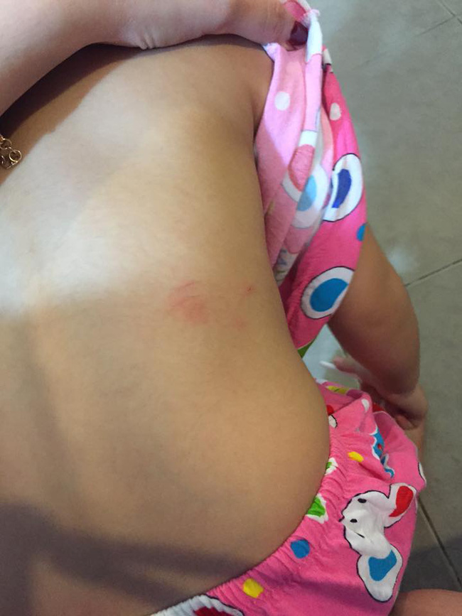 Phụ huynh bức xúc tố cô giáo trường MN quốc tế đánh con gái 3 tuổi trầy xước khắp người - Ảnh 2.