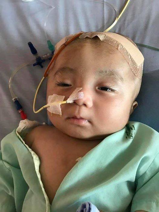 Em bé não úng thủy bị bỏ rơi trước cổng chùa đã ngưng thuốc, không còn khả năng phẫu thuật tại Singapore - Ảnh 1.
