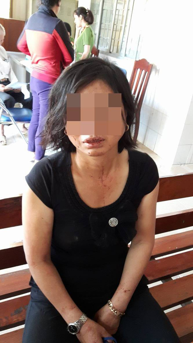 Con trai người phụ nữ bị chồng bạo hành tại Đồng Nai: “Mẹ bị cha dượng đánh suốt 23 năm nay - Ảnh 1.