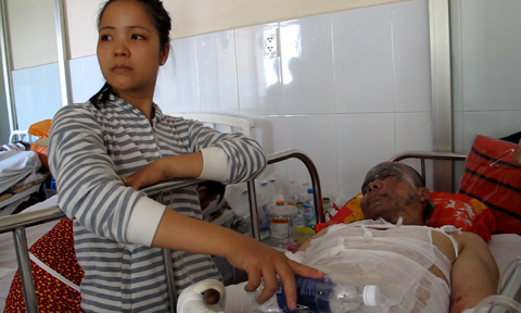 Nổ l&ograve; nung nh&ocirc;m ở B&igrave;nh Dương: Nạn nh&acirc;n bị phỏng 90% diện t&iacute;ch cơ thể - Ảnh 2.