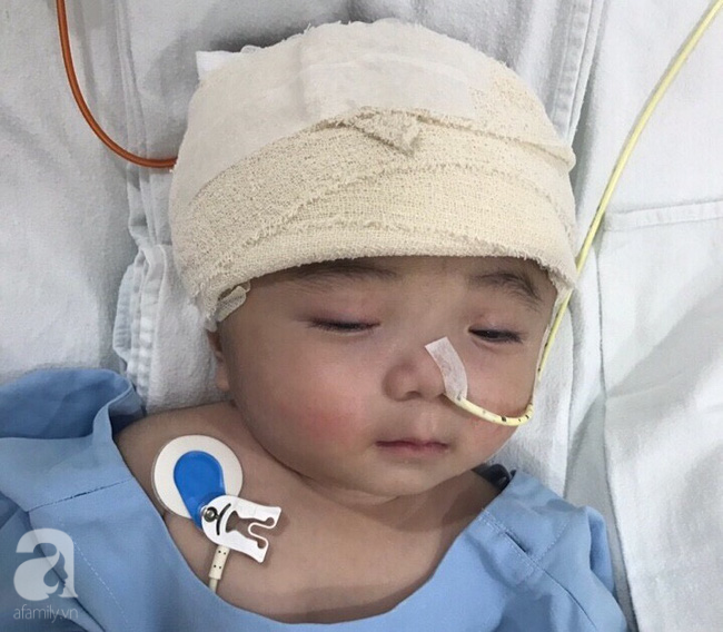 Một ngày sau cuộc tiểu phẫu, em bé não úng thủy Phạm Đức Lộc đã ...