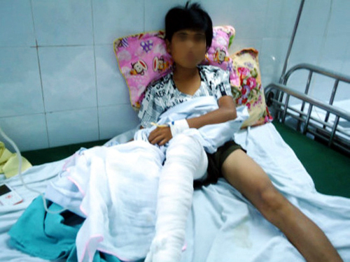 Tr&egrave;o tường r&agrave;o, nam sinh 13 tuổi bị hổ vồ tr&uacute;ng ch&acirc;n - Ảnh 2.