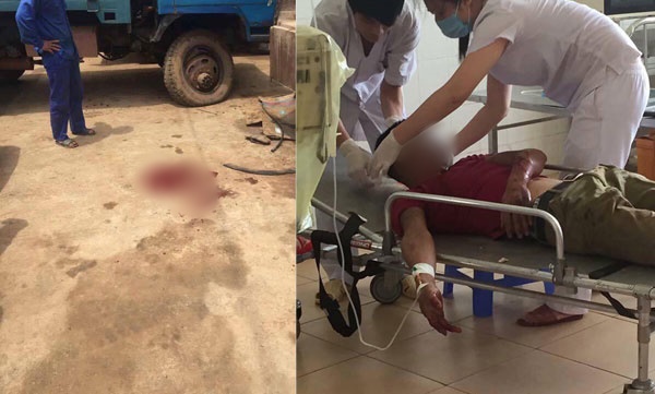 Đang bơm &ocirc; t&ocirc;, bất ngờ lốp nổ khiến nam thanh ni&ecirc;n tử vong  - Ảnh 2.