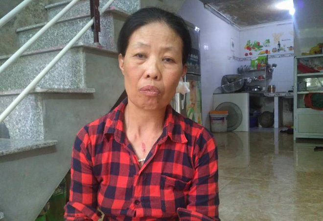 Hà Nội: Cả gia đình bất ngờ bị nam thanh niên lạ mặt lao vào đánh trọng thương - Ảnh 3.