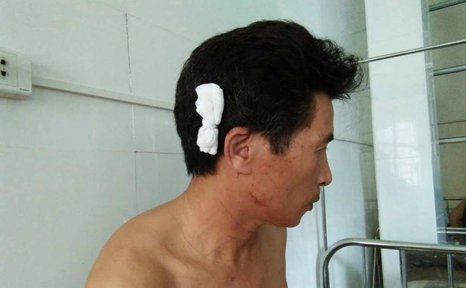 Hà Nội: Cả gia đình bất ngờ bị nam thanh niên lạ mặt lao vào đánh trọng thương - Ảnh 1.