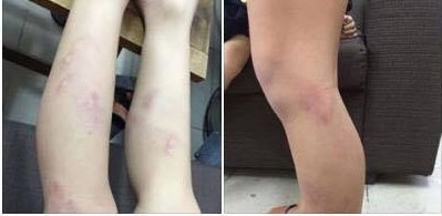 Chủ tịch HN: L&agrave;m r&otilde; vụ 11 học sinh lớp 2 bị gi&aacute;o vi&ecirc;n bạo h&agrave;nh - Ảnh 1.