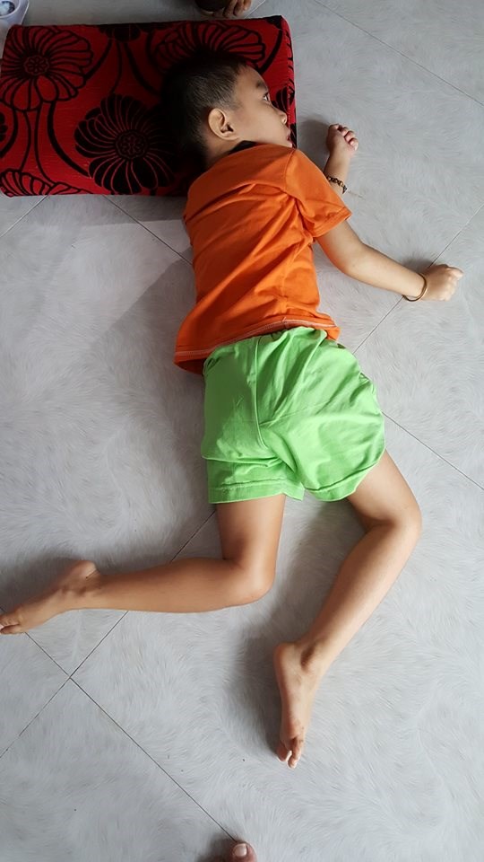 Bệnh viện bồi thường cho b&eacute; trai bị m&ugrave;, liệt sau mổ - Ảnh 2.
