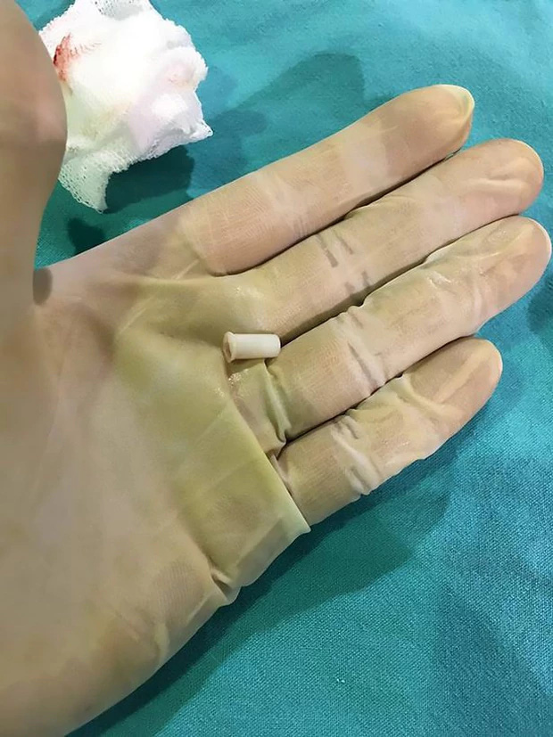 Đ&aacute;ng thương thay cậu b&eacute; nuốt phải c&aacute;i k&egrave;n, mỗi lần h&iacute;t v&agrave;o đều k&ecirc;u toe toe - Ảnh 1.