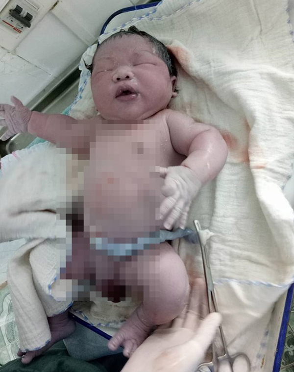 Câu chuyện thú vị về những em bé sơ sinh có cân nặng khổng lồ ở Việt Nam - Ảnh 1.