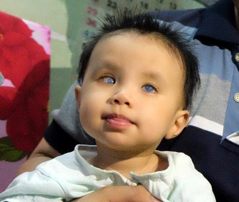 Hàng loạt bé mổ đục thủy tinh thể xong… không nhìn thấy gì - Ảnh 1.