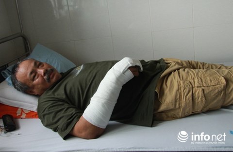 Đắk Lắk : Kinh hoàng tên trộm đâm chủ nhà 7 nhát chí mạng rồi tẩu thoát - Ảnh 2.