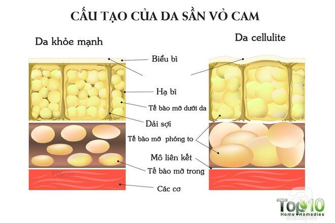 Nếu muốn da mịn màng, không bao giờ bị sần sùi như vỏ cam: Hãy áp dụng theo cách này - Ảnh 2.