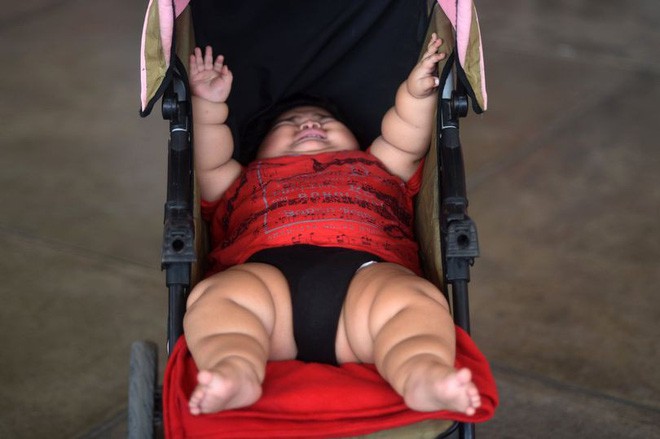 Con 10 tháng nặng 28kg, mẹ đinh ninh con hấp thu sữa mẹ tốt mà không ngờ có thể mắc bệnh đặc biệt - Ảnh 1.