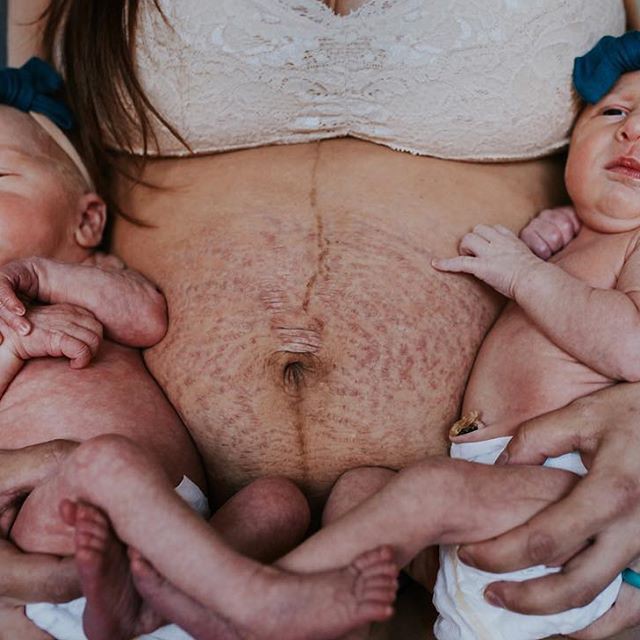 Con trai lớn hỏi Bụng mẹ bị l&agrave;m sao vậy v&agrave; đ&acirc;y l&agrave; c&acirc;u trả lời của người mẹ - Ảnh 1.