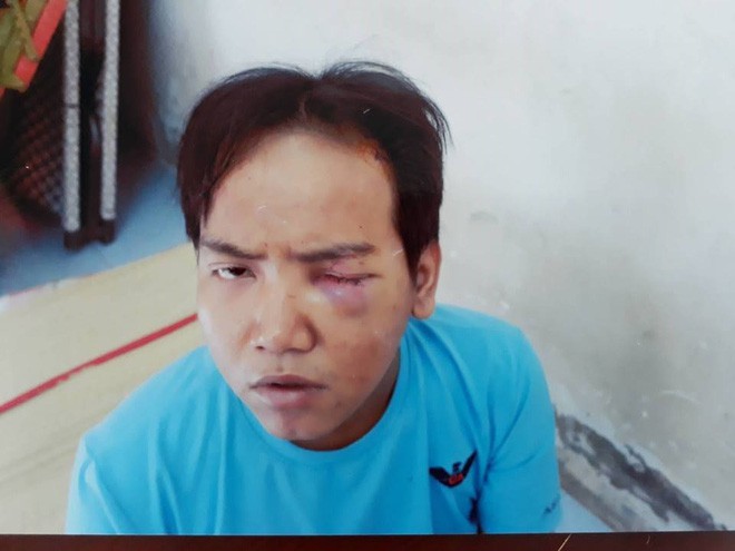 Từng bị bệnh tâm thần phân liệt, bảo vệ dân phố sát hại bé 6 tuổi ở Sài Gòn sẽ bị xử lý thế nào? - Ảnh 1.