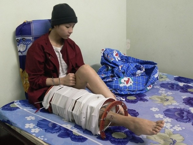 Mẹ vừa mới mất, người cha đau đớn nh&igrave;n con g&aacute;i 15 tuổi mắc bệnh ung thư xương &aacute;c t&iacute;nh m&agrave; kh&ocirc;ng tiền chữa trị - Ảnh 2.
