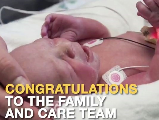 Mỹ ch&agrave;o đ&oacute;n em b&eacute; đầu ti&ecirc;n sinh ra từ b&agrave; mẹ được gh&eacute;p tử cung - Ảnh 1.