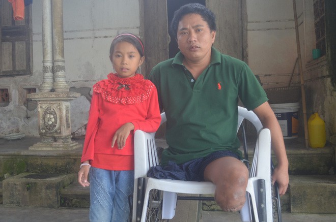 2 đời vợ, 2 ch&acirc;n bị cắt cụt, nguồn sống của người đ&agrave;n &ocirc;ng n&agrave;y g&oacute;i gọn ở c&ocirc; con g&aacute;i nhỏ - Ảnh 1.