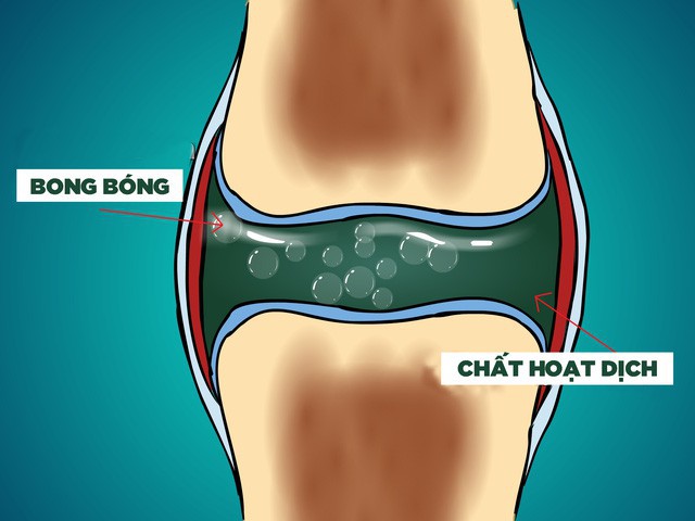 Chuyên gia tự bẻ khớp tay suốt 60 năm liền chỉ để chứng minh một điều nho nhỏ - Ảnh 2.