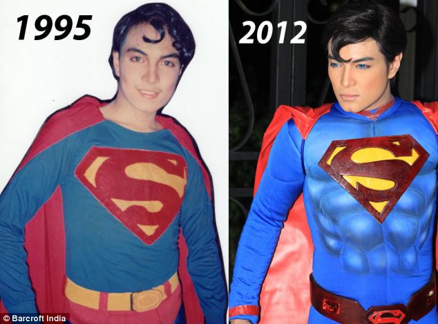 Chàng trai người Philippines vung tiền thẩm mỹ để giống hệt Superman, chỉ thiếu mỗi nước học bay - Ảnh 5.