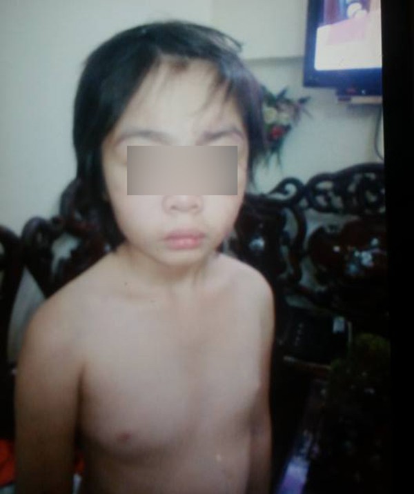 Hà Nội: Bé trai 10 tuổi bị bố và mẹ kế bạo hành phải trốn tìm ông ...