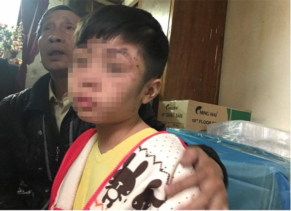 B&eacute; trai 10 tuổi bị bạo h&agrave;nh: Đến bữa ăn, bố v&agrave; c&ocirc; b&ecirc; m&acirc;m v&agrave;o trong ph&ograve;ng, c&ograve;n ch&aacute;u th&igrave; ăn ở ph&ograve;ng ngo&agrave;i - Ảnh 1.